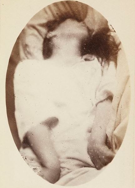 a still image of a generalized seizure