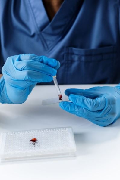 a person in blue gloves holding a dropper and a glass slide with blood sample