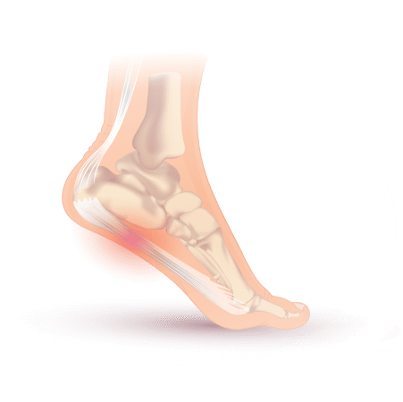 Pain under your heel