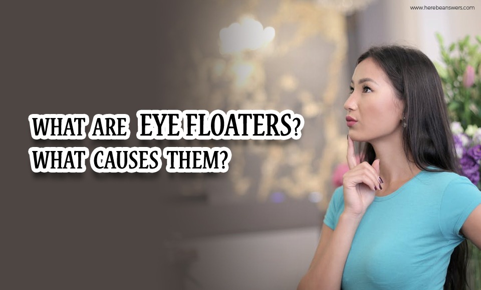 What are eye floaters? What causes them